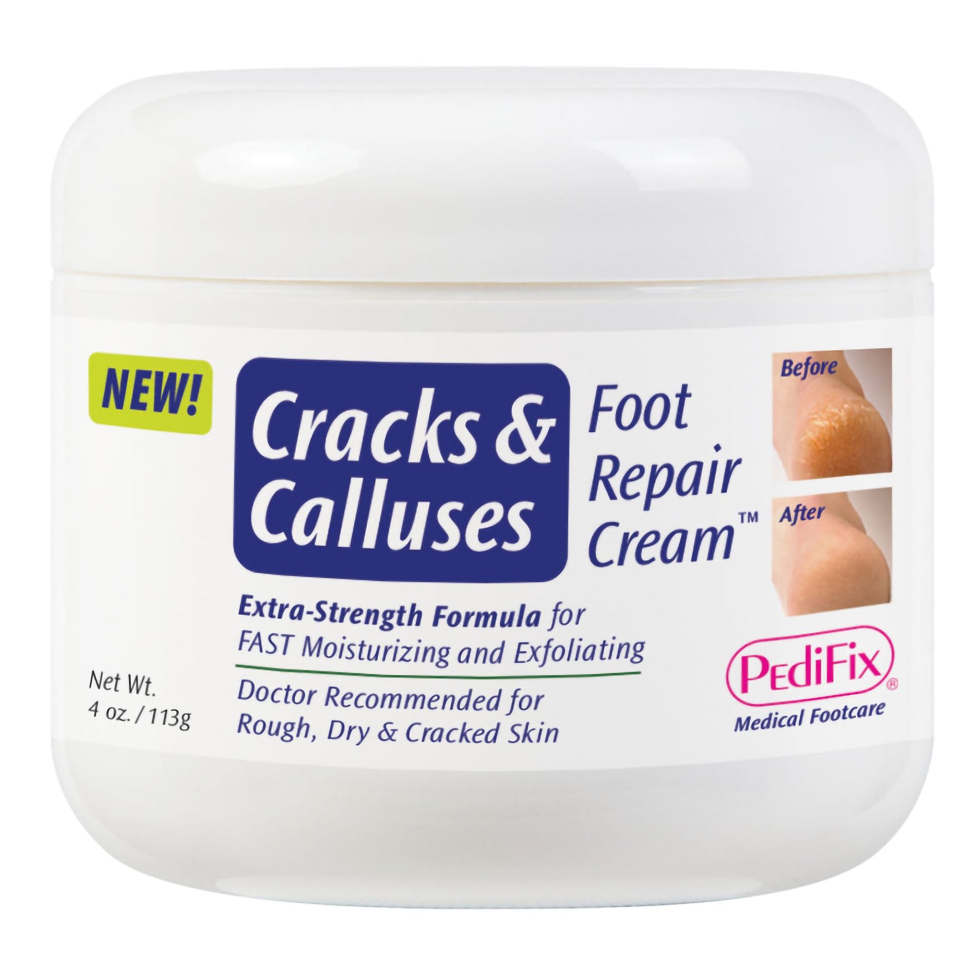 Pedifix Krem hidratues për këmbët, plasaritje dhe kalluse, kavanoz 4 Oz. Krem me aromë MK