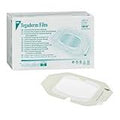 Tegaderm Transparenter Klebefilm-Verband im Rahmenstil 15 x 20 cm – 1 St.